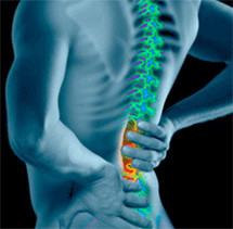 Spondylarthrite ankylosante : quelles sont les personnes à risque ?